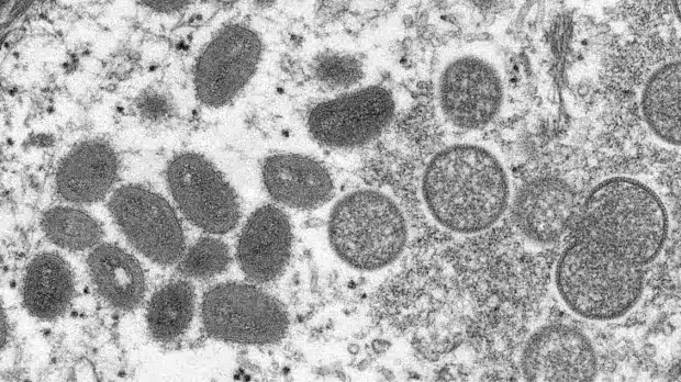 AI Just Created 16 Brand-New Viruses