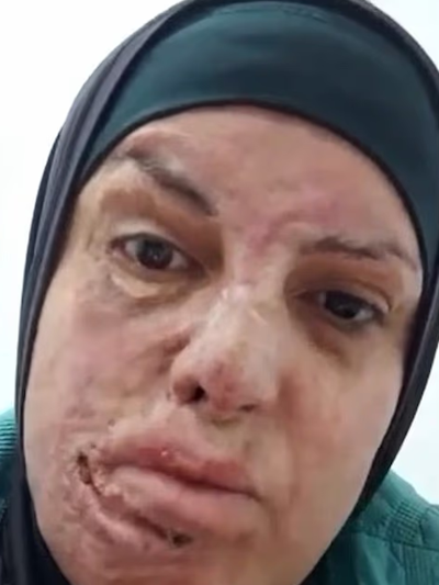 Would-be Palestinian suicide bomber is APPLAUDED as she appears before woke Berkeley students