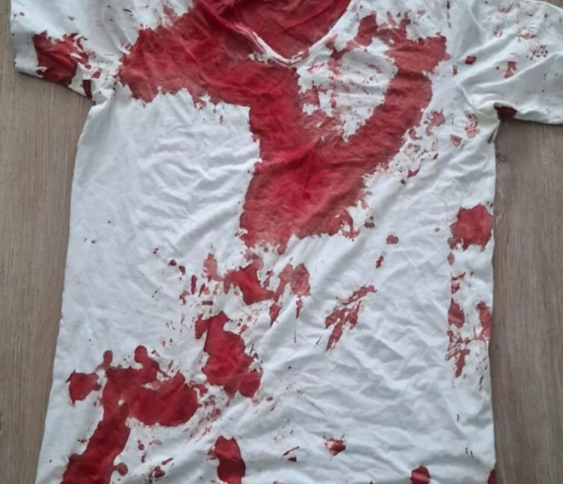 AfD State Parliament Member Assaulted by Left-Wing Extremists Outside His Home
